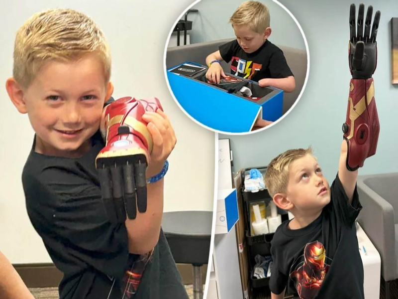 Jorda-Marotta-on-bionic-arms-and-robotic-thumbs